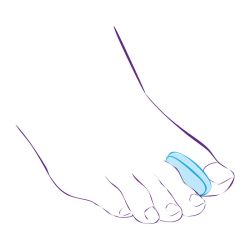 СТ-32 (L) Межпальцевый вкладыш