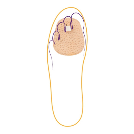 Корректор одного пальца СТ-221  Trives