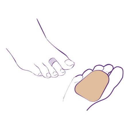 Корректор одного пальца СТ-221  Trives