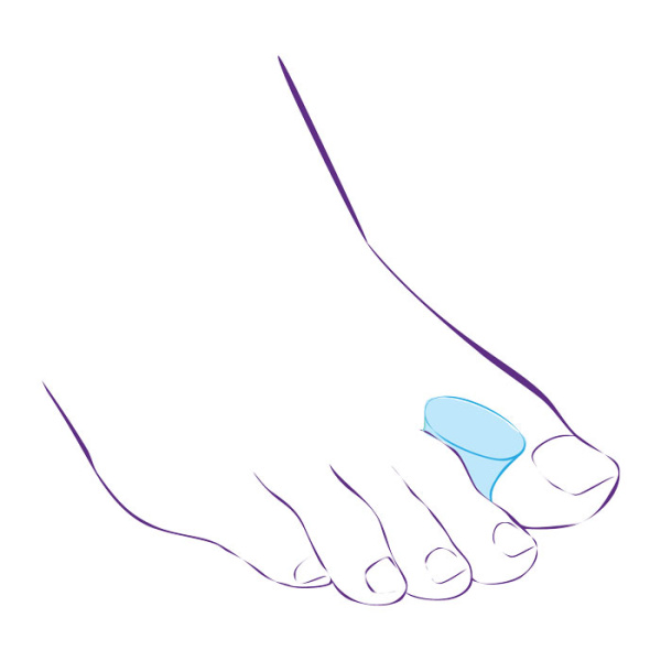 Перегородки межпальцевые увеличенного размера СТ-51  Trives